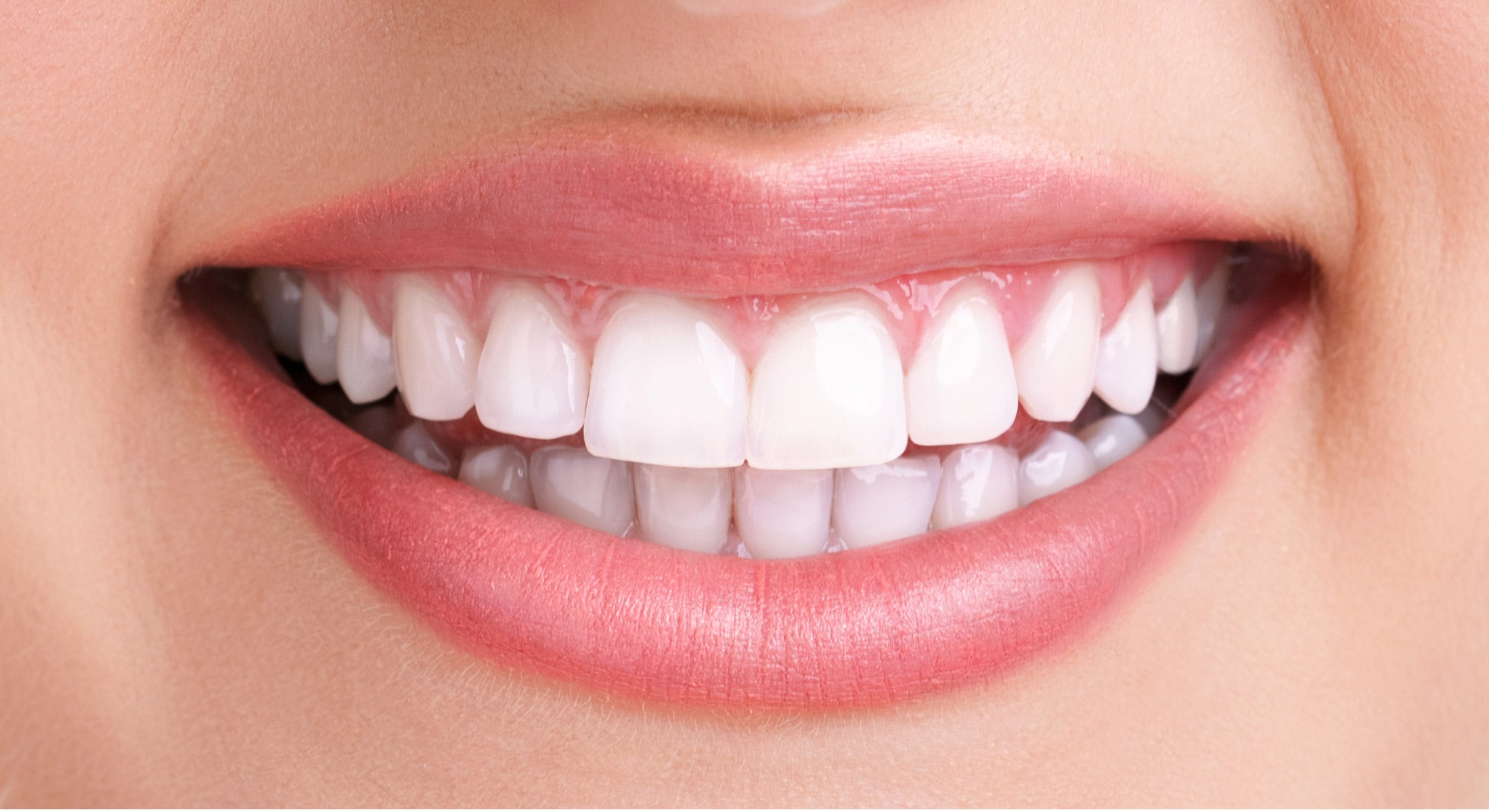 Implant dentaire Lyon : quels peuvent être les désavantages ?